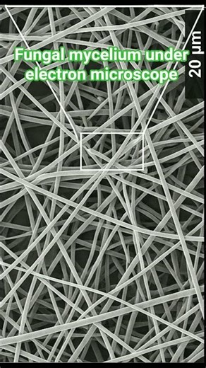 Fungal mycelium under electron microscope #biology #fungi #mycelium #sem #microscope