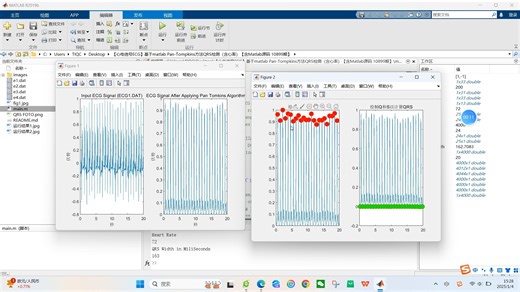 【心电信号ECG】基于matlab Pan-Tompkins方法QRS检测（含心率）【含Matlab源码 10899期】