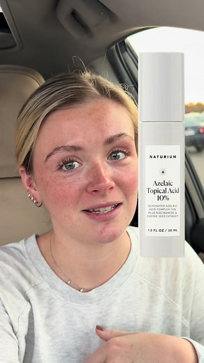 Naturium Azelaic Acid: Clear Skin Results Revealed