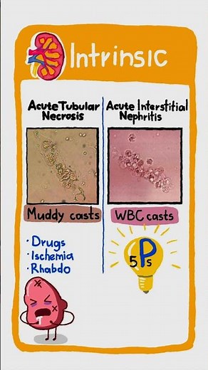 Acute Kidney Injury in 60s 💧❌