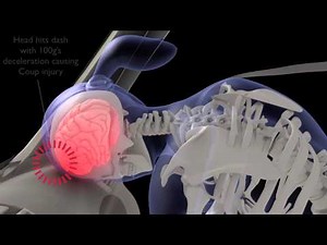Animation Accident Slow Motion Biomechanical Keynote