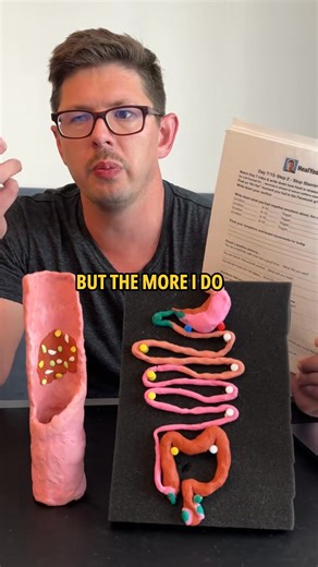 SIBO - Diagnosis, Symptoms and Natural Treatment Plan | Heal Your Gut Guy