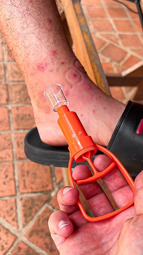 ¡Este extractor de veneno puede SALVAR tu vida en medio del bosque! 🤯 | Soy el Barone