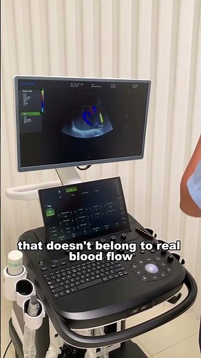 Ultrasound 101 – Color Gain in Doppler Mode Explained #DaweiMedical #ultrasound #ultrasoundbasics