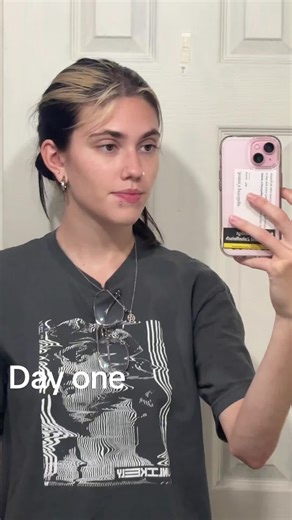 Healed Snakebite Piercings: From Day One to 33