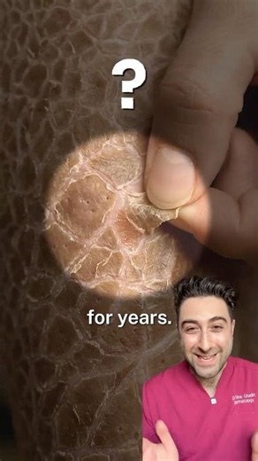 You Thought This Was Just “Eczema”?