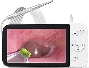 Digital Otoscope with Light, Ear Camera with Ear Wax Removal Tool, ScopeAround Ear Cleaning Camera with 5" Screen for Kids, Adults & Pets, Ear Scope, 32GB Card Supports Photo and Video Recording.