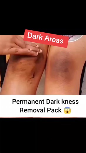 Exploring Dark Areas: Insights and Discoveries