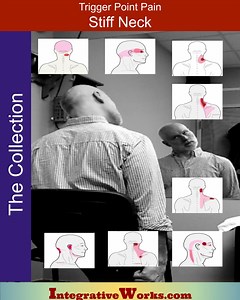 Stiff Neck: Pain Patterns and Self-Care Conditions and Syndromes