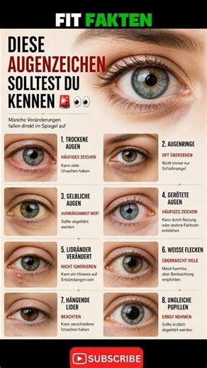 Diese Augenzeichen solltest du kennen 👀🚨 | Was deine Augen über deine Gesundheit verraten #fitfakten
