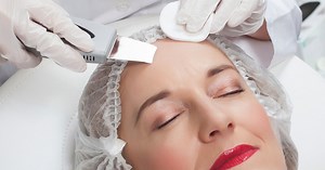 Médecine esthétique : focus sur le peeling au laser fractionné pour lisser la peau