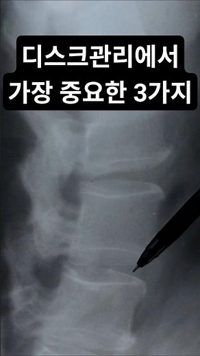 디스크 관리에서 가장 중요한 3가지 (지금 바로 체크하세요) #디스크관리 #허리건강#목건강 #생활습관 #건강관리 #중년건강 #디스크닥터 #척추건강 #홈케어 #Shorts