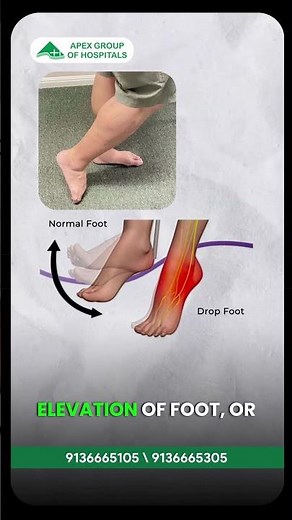 The Truth About Knee Dislocation Injuries — Doctor Explains | Dr Saurabh Talekar | Apex Hospitals