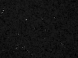 File:Migration-of-Periodontal-Ligament-Fibroblasts-on-Nanometric-Topographical-Patterns-Influence-of-pone.0015129.s001.ogv - Wikimedia Commons