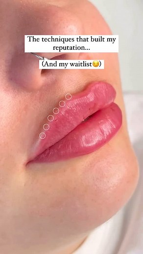 Abi Farrow + Team of Aesthetic Experts | Want results that rebook themselves? Comment SKILL below ⤵️ Every injector wants to feel confident treating any lip shape - but most are... | Instagram