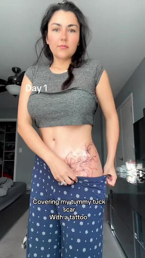 Covering Tummy Tuck Scar with First Tattoo