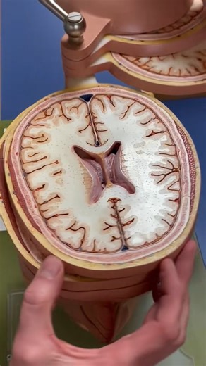 FISIOTERAPIA CURITIBA | PILATES on Instagram: "O plano axial é, na prática, o mesmo que o plano transversal ou horizontal. Ele divide o crânio em porção superior e inferior, sendo um dos planos mais utilizados na anatomia e nos exames de imagem. 🔍 O que aparece nos cortes axiais do crânio? Dependendo do nível do corte, é possível visualizar: 🧠 Hemisférios cerebrais e giros corticais 🧩 Ventrículos laterais, terceiro e quarto ventrículo 🎯 Núcleos da base (caudado, putâmen, globo pálido) 🧠 Tál