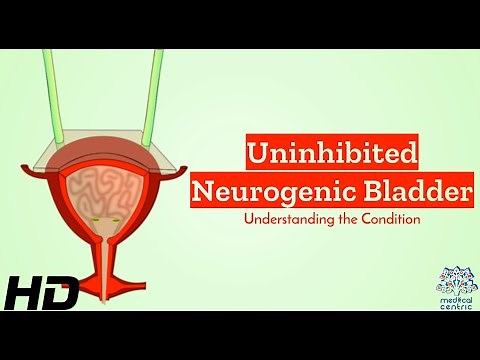 Uninhibited Neurogenic Bladder Demystified: A Closer Look at the Condition
