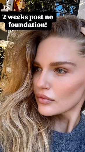 Rachel Mortenson | Im always curious about real time healing and results with skin lasers... so come with me to my favorite, @doctor.ardalan for a Fraxel... | Instagram