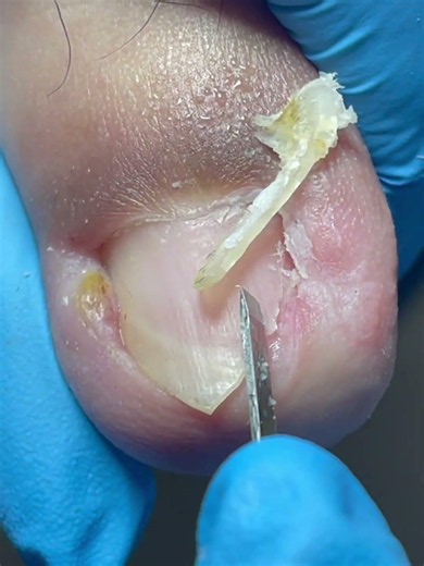 An Enormous Inlaid Armor Was Pulled Out From The Base! #foot #satisfying