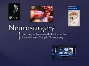 Neurosurgery - SlideServe