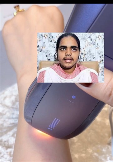 Ultimate Guide to Laser Hair Removal with Ulike