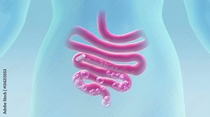 Cure for flatulence. High quality animation of cure for flatulence. Animated pill eliminates flatulence in the body. Include two animations and pill separate mask.