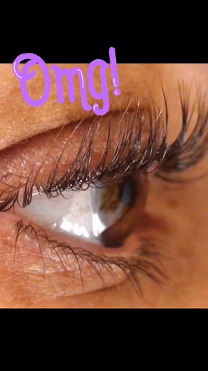 2.6K views · 23 reactions | Latisse is a prescribed serum that makes your eyelashes thicker and longer! I’ve seen great results. #eyelash #doctorsoftiktok #eyelashextensions | Dr. Brian Boxer Wachler | Facebook