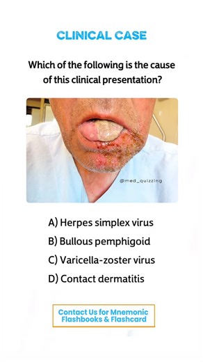𝑴𝒆𝒅 𝑸𝒖𝒊𝒛𝒛𝒊𝒏𝒈 on Instagram: "Comment “Details” and check your inbox for the full mnemonic flashbook & flashcards! 📕✨ . . . . . . #medical #medicine #medicalstudent #medicinestudent #usmle #step1 #plab #mrcp #medicine #reels #viral #foryou #anatomy #reelexplore #instagram #neurology #nephrology #surgery #students #colleges #cardiology #knowledge #virals #plab #UK #USA #newyork #nyc #neet"