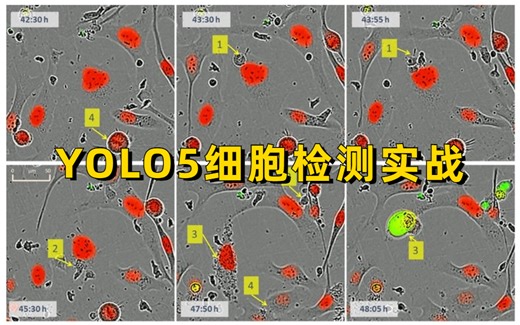 【YOLO5细胞检测实战】没想到同济大学计算机博士竟然一次性讲透了YOLO系列物体检测算法-YOLO5细胞检测实战！人工智能/深度学习/机器学习