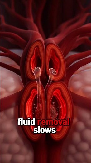 When Kidneys Fail: The Silent Fluid & Electrolyte Imbalance Inside Your Body