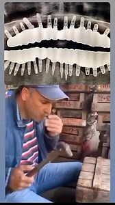 147K views · 199 reactions | Post by • @alldentfor Full mouth implantation 醴醴 . . . Via @nocontextseyadsm . #dentalimplants #dental #dentistry #dentistryworld #oralcare #oralhygiene #orthodontics #endodontics #endodontist #dentalclinic | identistry | Facebook