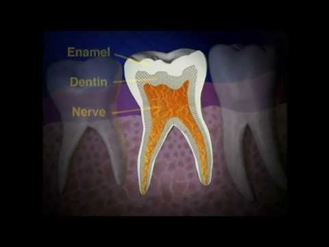 Pulpectomy to Save Nerve Damaged Tooth | Lake Merritt Dental, Oakland, CA
