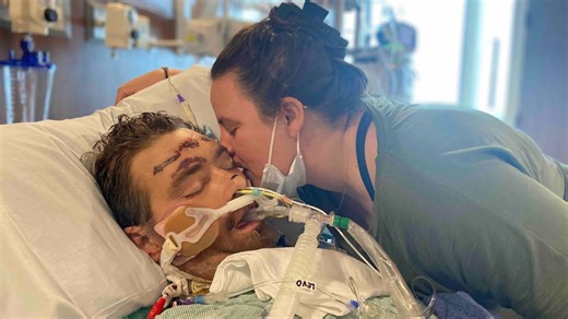 Man who pulled out ingrown hair and was then given 4% chance of surviving wakes up from coma