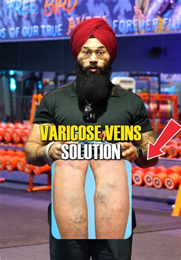 Varicose veins are not just about looks… they come with heaviness, swelling, and discomfort in your legs 🦵 especially if you sit or stand for long hours. Most people ignore it until it starts affecting daily life 🚨 With the right stretches and simple movements, you can improve blood circulation, reduce pressure in your veins, and feel real relief 💪🏼✨ Consistency is key 🔑 Start taking care of your legs today and follow these exercises regularly 🙌🏼 Your body will thank you ❤️ If you need pr