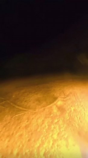 Ethan Brown and crew have one heck of a setup for bowfishing and gigging 🔥🔥🔥 Swamp Eye Submersibles making it happen!💥 #OutriggerOutdoors #SwampEye #SwampEyeLights #FlounderGigging #Bowfishing #SwampEyeSubmersibles | Outrigger Outdoors