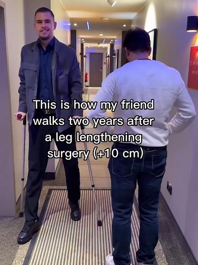 The Painful Truth About Leg Lengthening Surgery