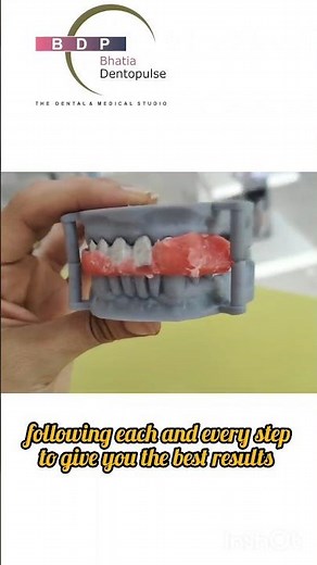 Steps in Dental Bridge Making #dentist #newteeth #teeth