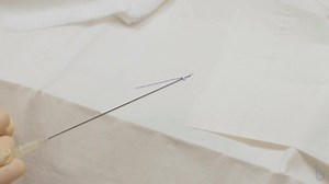 Novathreads skin-lifting treatment