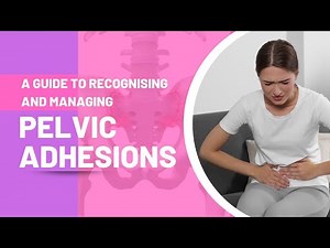 A Guide to Recognising and Managing Pelvic Adhesions
