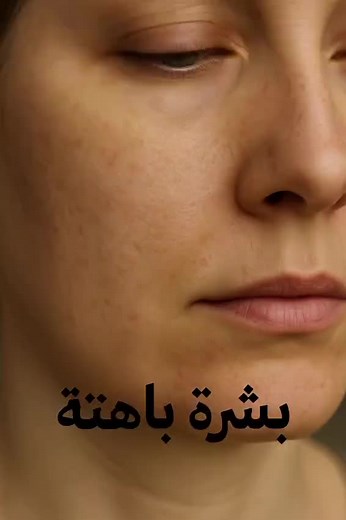 ✨ Discover the beauty of organic skincare & makeup – made in Germany. Feel natural. Look radiant. ✨ Contact us: 70347802 #GermanBeauty #OrganicSkincare #CleanBeauty #MadeInGermany #NaturalGlow #VeganMakeup #SkincareRoutine #ReelBeauty #SommerGlow