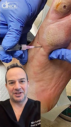 This will heal a callus!!