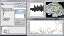 Brainstorm: Imaging Neural Activity at the Speed of Brain with MATLAB