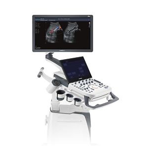 [Hot Item] P25 Mobile 3D/4D Color Doppler Ultrasound Scanner