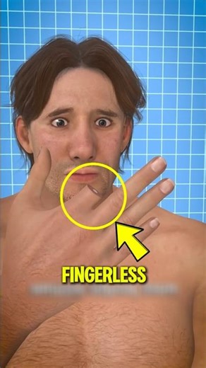 If you ever CUT YOUR FINGER...