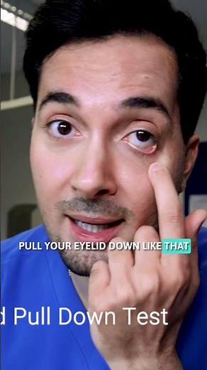 PALE EYELID? Check For Anemia! #shorts