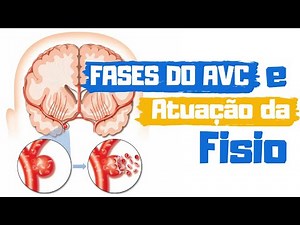 Fases do AVC e atuação da FISIOTERAPIA