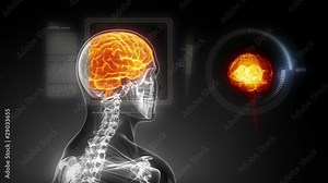 Human brain medical x-ray scan in loop