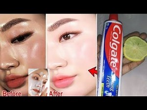 Colgate toothpaste for face whitening | Lemon and colgate