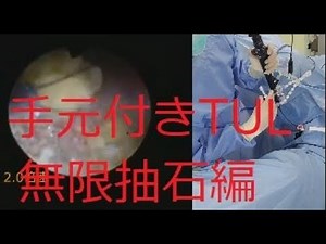 Includes video of the hands! TUL Explanation Video ⑥